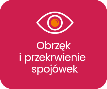 Obrzęk u przekrwienie spojówek